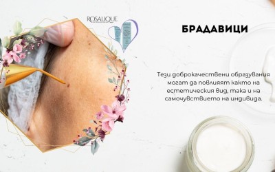 Брадавици по лицето - същност, видове, премахване