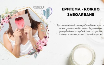 Еритема и други кожни проблеми