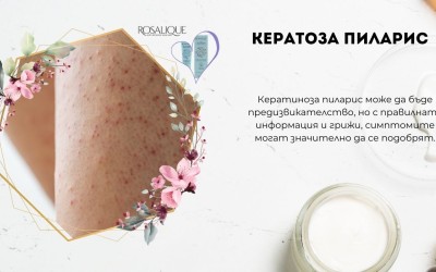 Кератоза пиларис - същност, причини, симптоми