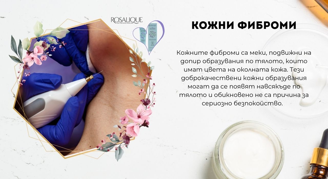 Кожни фиброми