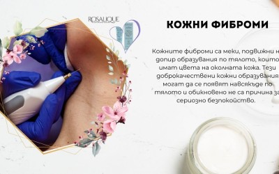Кожни фиброми