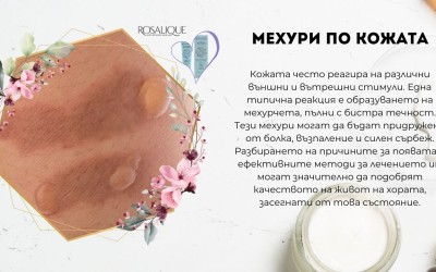 Мехури по кожата - същност, причини и лечение 
