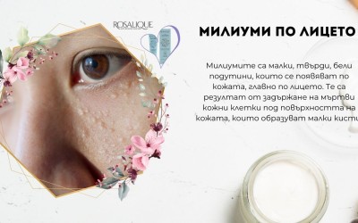 Милиуми по лицето - причини за тяхната поява