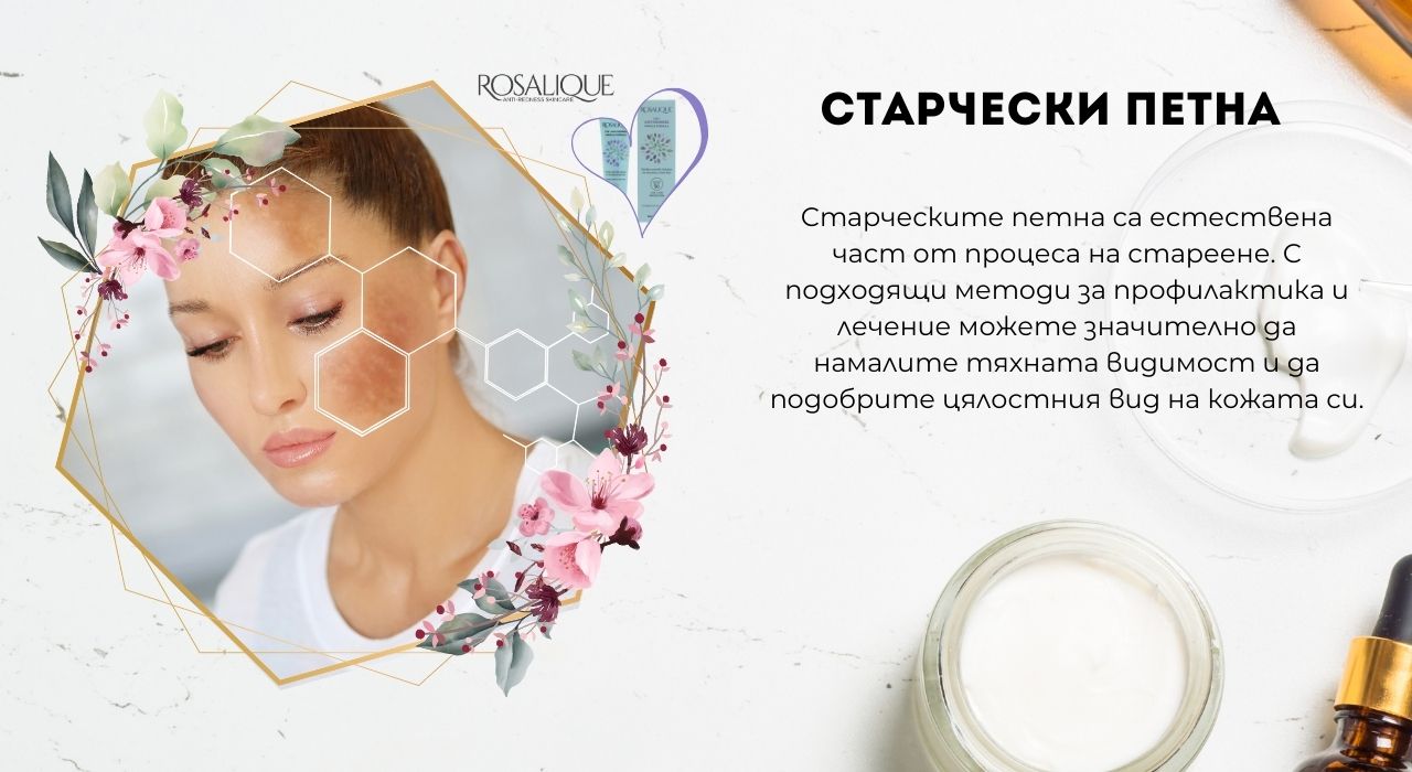 Старчески петна - признак за стареене