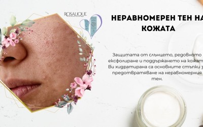 Стареене и неравномерен тон на кожата