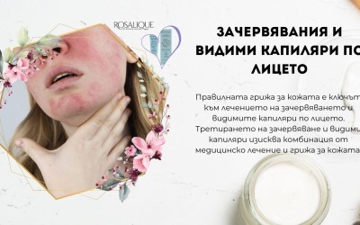 Зачервявания и видими капиляри по лицето 
