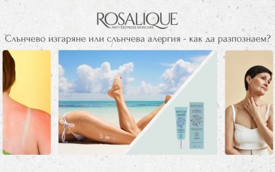 Слънчево изгаряне или слънчева алергия - как да разпознаем?